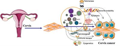 Implications of viral infections and oncogenesis in uterine cervical carcinoma etiology and pathogenesis